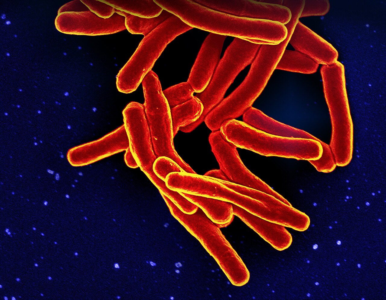 Tuberkulose Infoseite